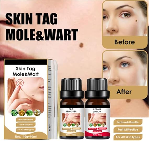 2X1 SKIN TAG MOLE & WART™  - TONICO Y CREMA ELIMINADOR DE VERRUGAS, LUNARES Y MARCAS EN LA PIEL